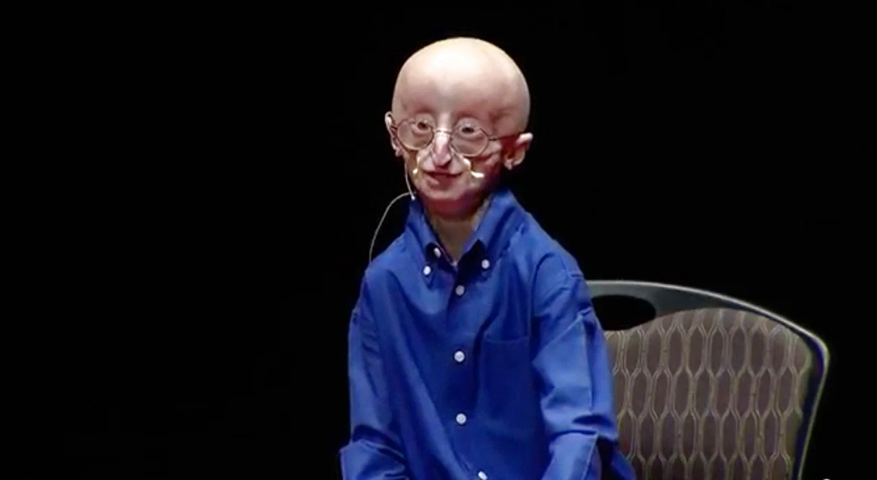 Video: Sam Berns – My Philosophy for a happy life